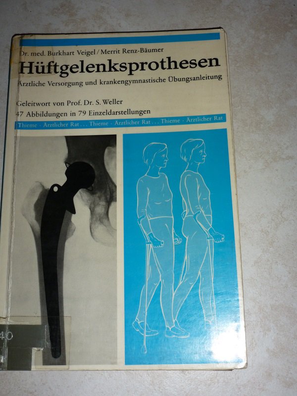 Hüftgelenksprothesen
