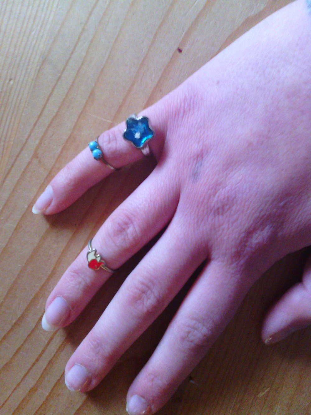 verschiedene Ringe